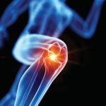 knee-1920w[1]